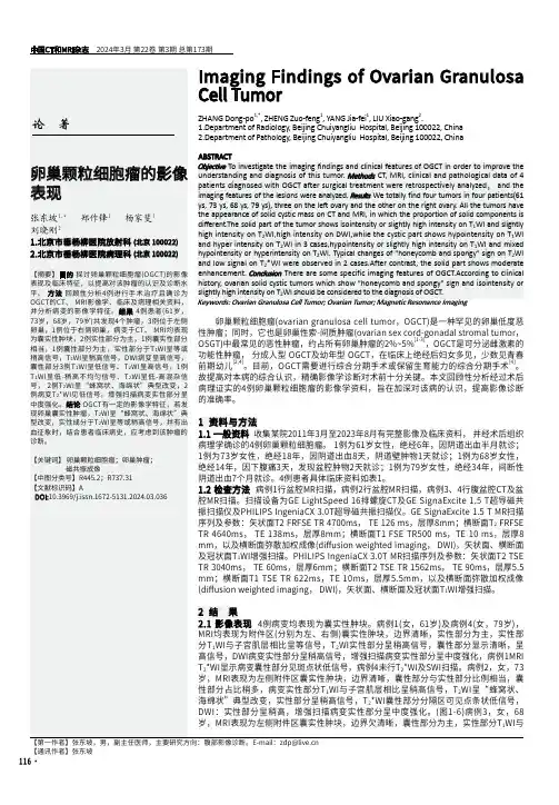 卵巢颗粒细胞瘤的影像表现