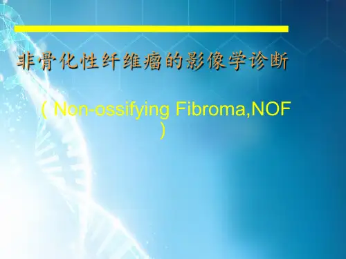 非骨化性纤维瘤的影像学诊断ppt课件
