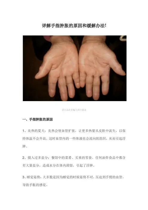 详解手指肿胀的原因和缓解办法