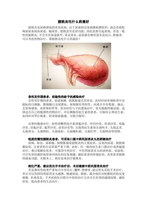 膀胱炎吃什么药最好