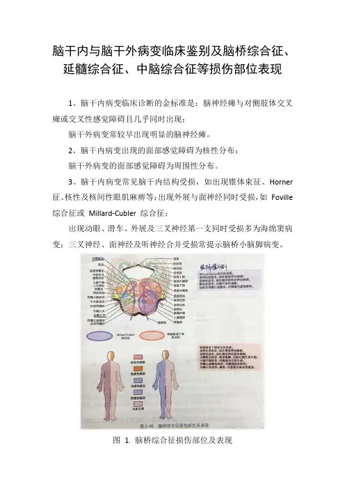脑干内与脑干外病变临床鉴别及脑桥综合征、延髓综合征、中脑综合征等损伤部位表现