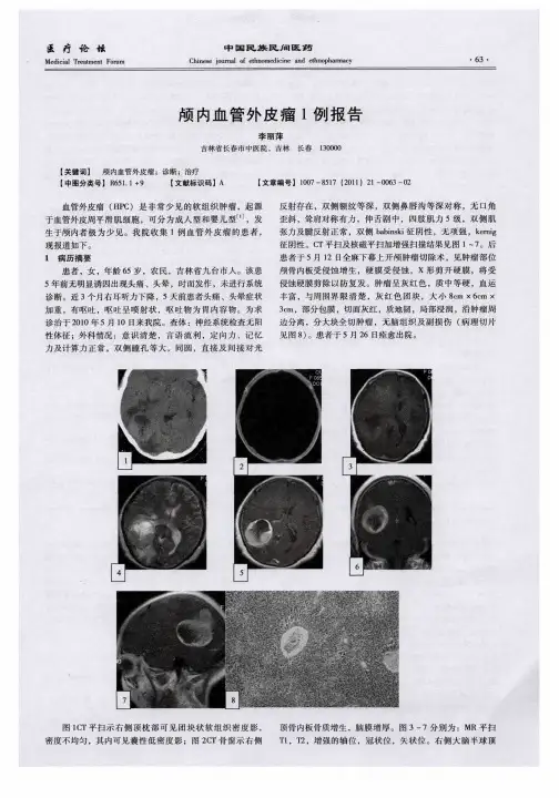 颅内血管外皮瘤1例报告