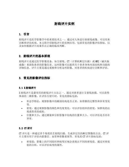 射线评片实例