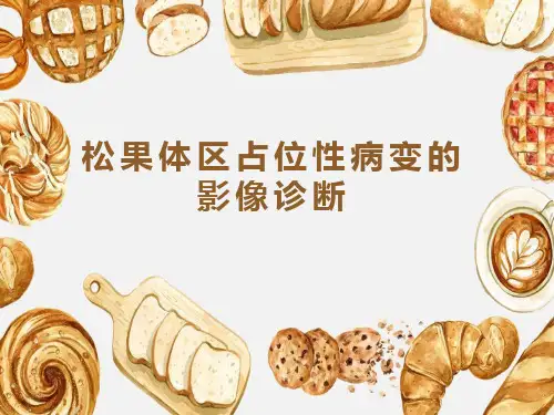 松果体区占位性病变的影像诊断