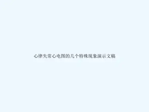 心律失常心电图的几个特殊现象演示文稿