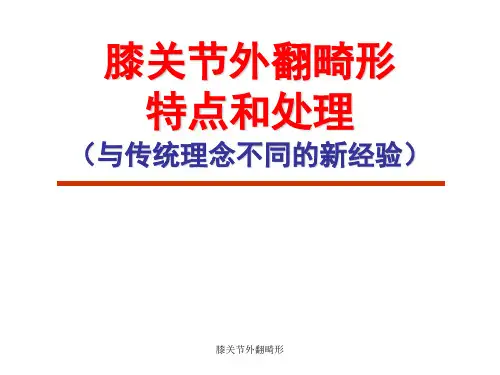 膝关节外翻畸形 ppt课件