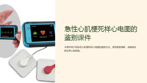 急性心肌梗死样心电图的鉴别课件