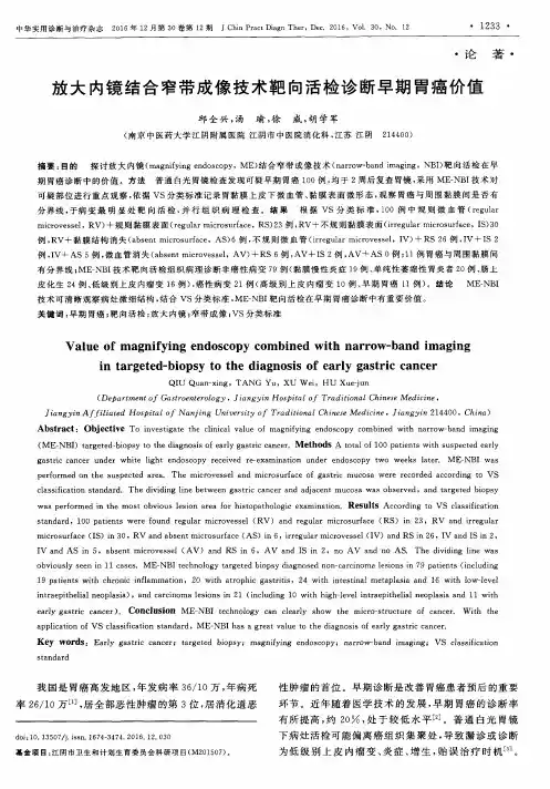 放大内镜结合窄带成像技术靶向活检诊断早期胃癌价值