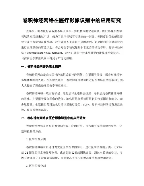 卷积神经网络在医疗影像识别中的应用研究