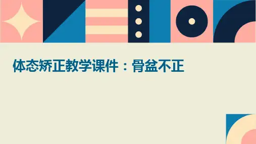 体态矫正教学课件骨盆不正