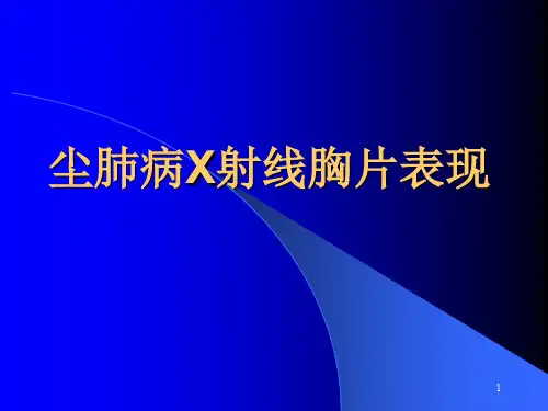 尘肺X线表现ppt课件