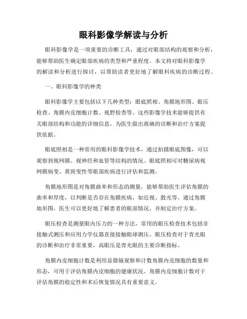 眼科影像学解读与分析