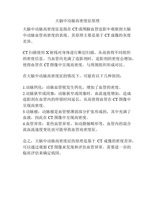 大脑中动脉高密度征原理