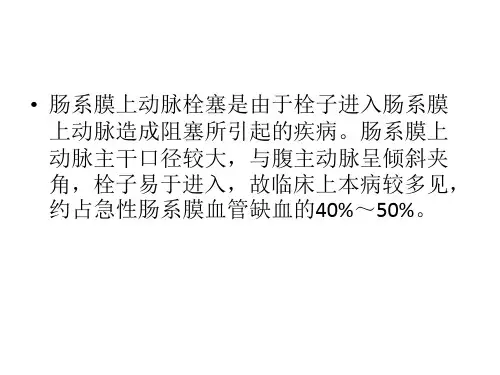 肠系膜上动脉栓塞