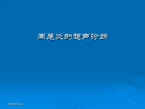 阑尾炎超声诊断 ppt课件