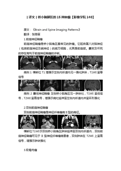 丨译文丨桥小脑脚区的15种肿瘤【影像学院140】