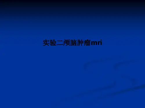 实验二颅脑肿瘤mri