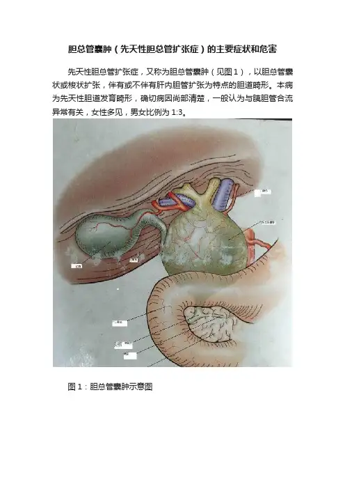 胆总管囊肿（先天性胆总管扩张症）的主要症状和危害