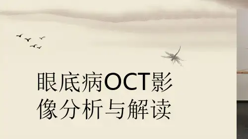 眼底病OCT解读PPT演示幻灯片