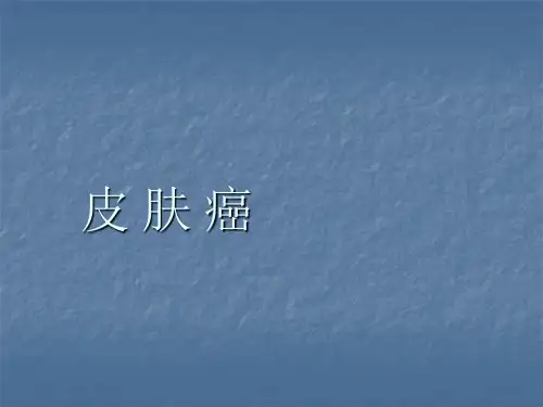 皮肤癌ppt课件