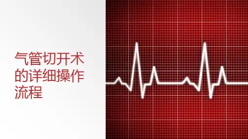 气管切开术的详细操作流程
