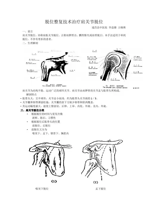 脱位整复技术治疗肩关节脱位