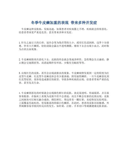 冬季牛皮癣加重的表现 带来多种并发症