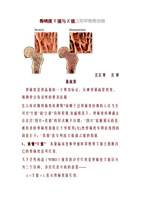 BMD-9超声骨密度参数及报告单说明