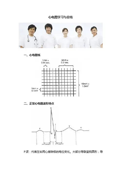 心电图学习与总结