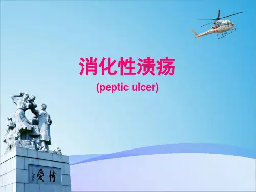 消化性溃疡 PPT精品课件