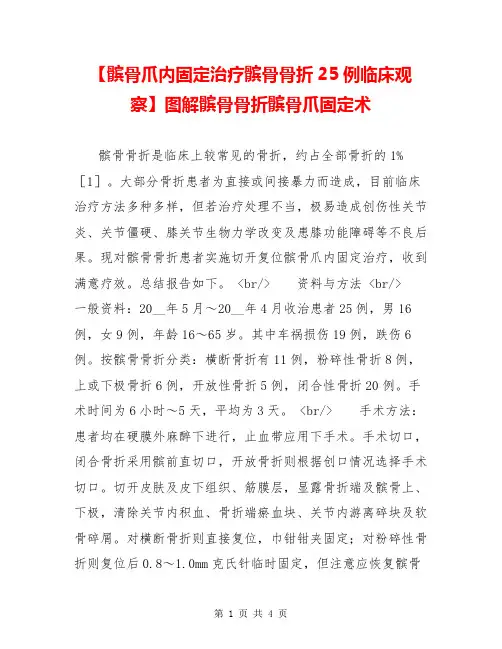 【髌骨爪内固定治疗髌骨骨折25例临床观察】图解髌骨骨折髌骨爪固定术