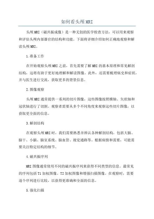 如何看头颅MRI