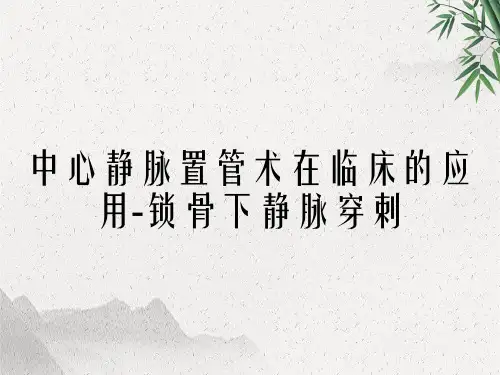 中心静脉置管术在临床的应用锁骨下静脉穿刺