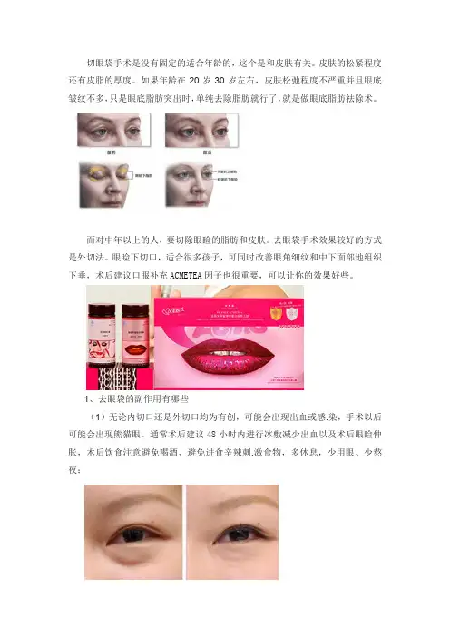 眼袋去除有没有合适的年龄一说？