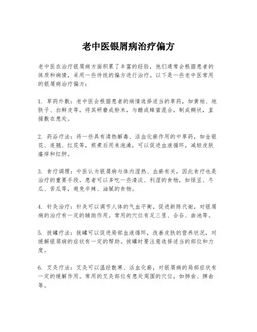 老中医银屑病治疗偏方