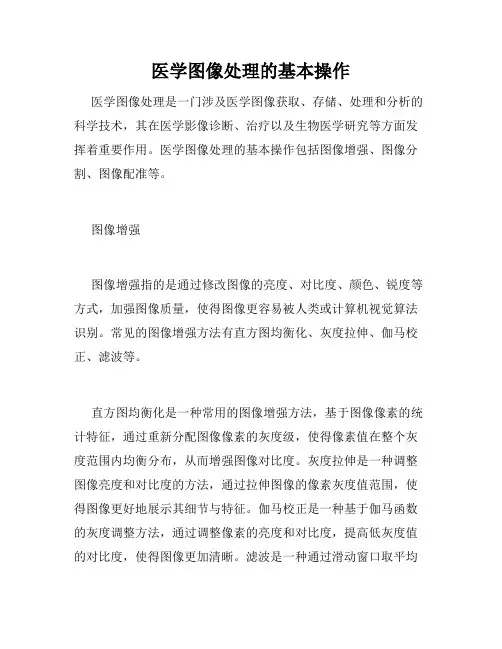 医学图像处理的基本操作
