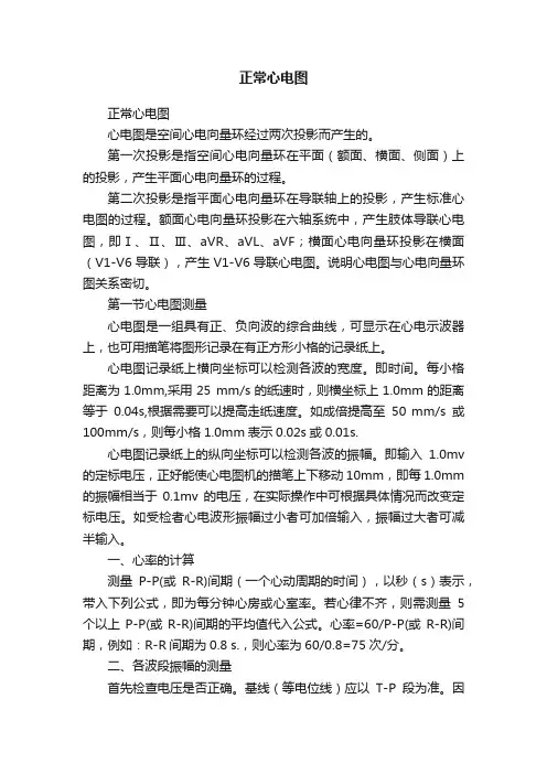 正常心电图