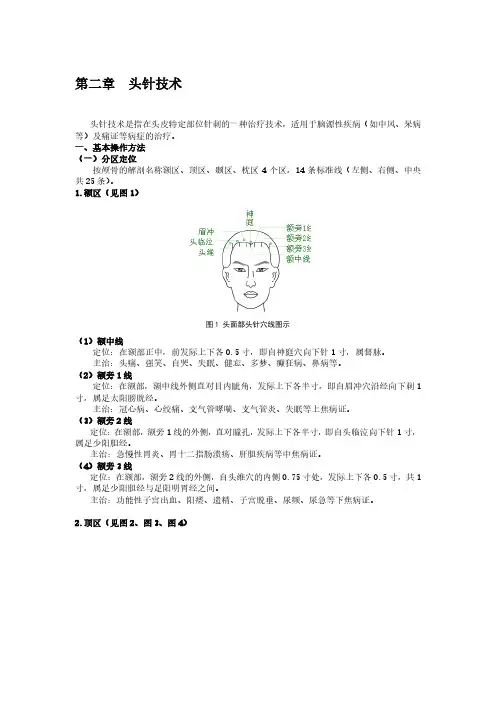 中医经典  头针技术