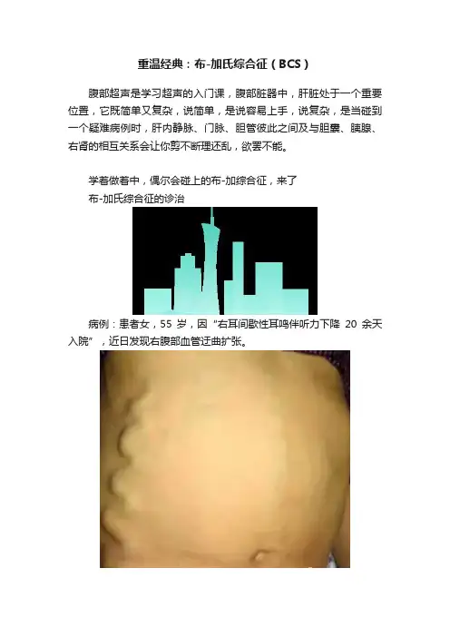 重温经典：布-加氏综合征（BCS）