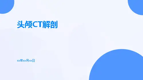 (医学课件)头颅CT解剖