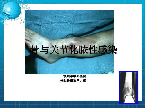 《骨与关节感染》PPT课件