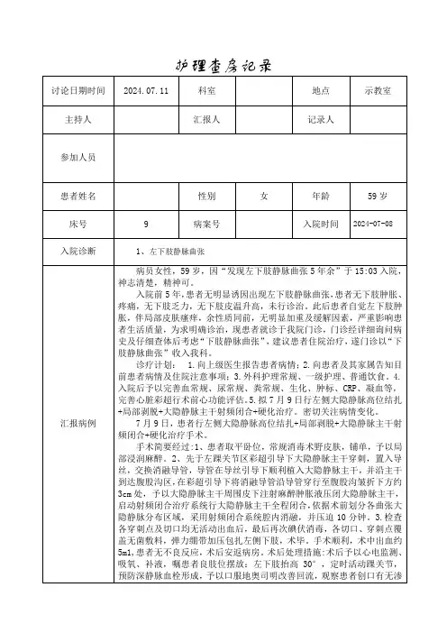 护理查房(静脉曲张).doc