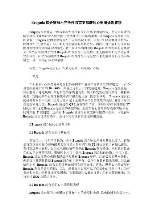 Brugada综合征与不完全性右束支阻滞的心电图诊断鉴别