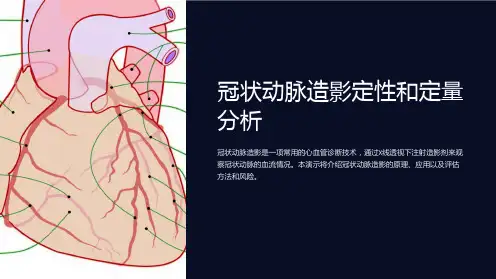 冠状动脉造影定性和定量分析
