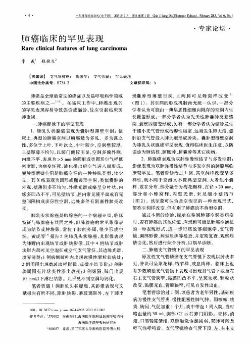 肺癌临床的罕见表现