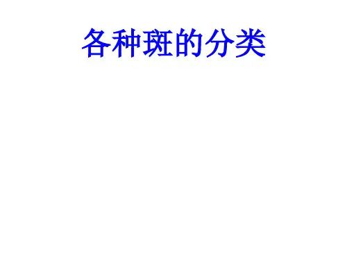 各种斑的分类PPT培训课件