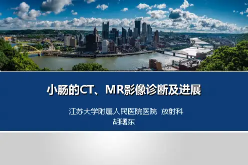 小肠的CT、MR影像诊断及进展新版(简版)ppt课件