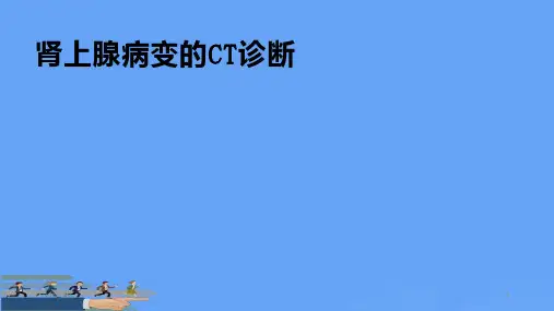 肾上腺病变的CT诊断优选PPT