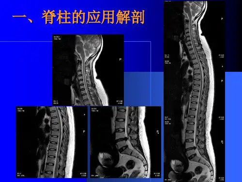 脊柱CT扫描技术ppt课件