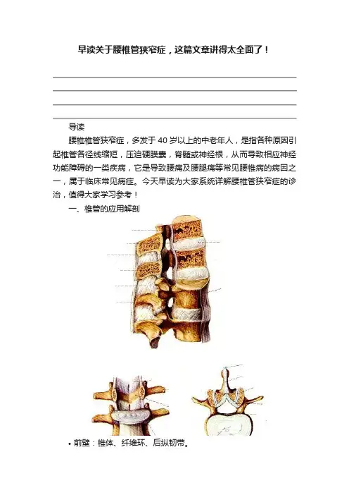 早读关于腰椎管狭窄症，这篇文章讲得太全面了！
